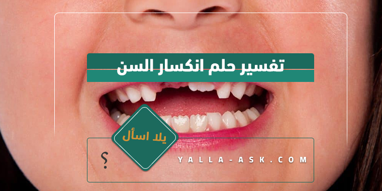 تفسير حلم انكسار السن