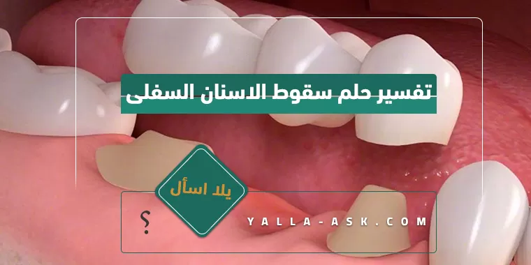 تفسير حلم سقوط الاسنان السفلى