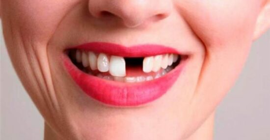 تفسير حلم سقوط الأسنان الأمامية في اليد بدون ألم ودم بكافة تأويلاتها - موجز مصر