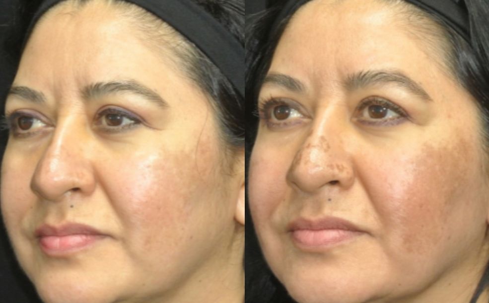 eed71b64 693e 11ed 8cb8 0050568b0c83 - اسرار تفسير الاحلام