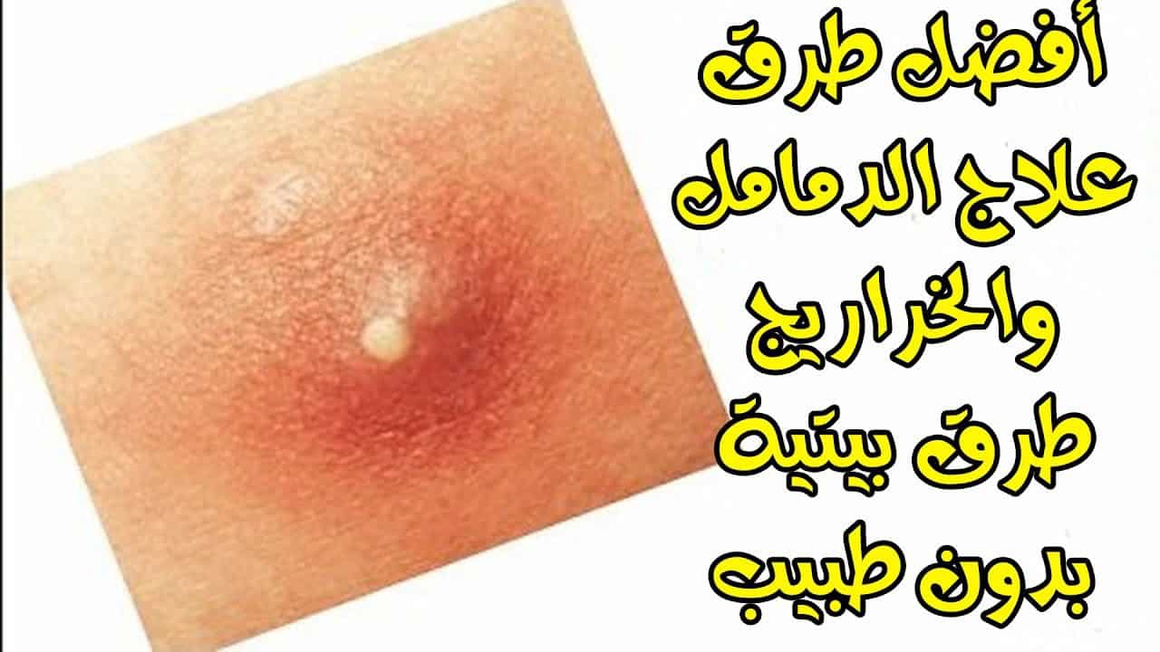 معلومات عن مرهم اكتيول المرهم الاسود لعلاج الدمامل
