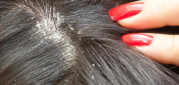 ما هو تفسير رؤية الصيبان في المنام لابن سيرين؟