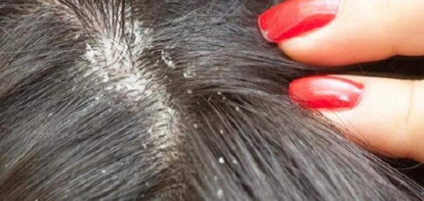 رؤية-ما-هو-تفسير-رؤية-الصيبان-في-المنام-لابن رؤية - ما هو تفسير رؤية الصيبان في المنام لابن سيرين؟ بالتفصيل